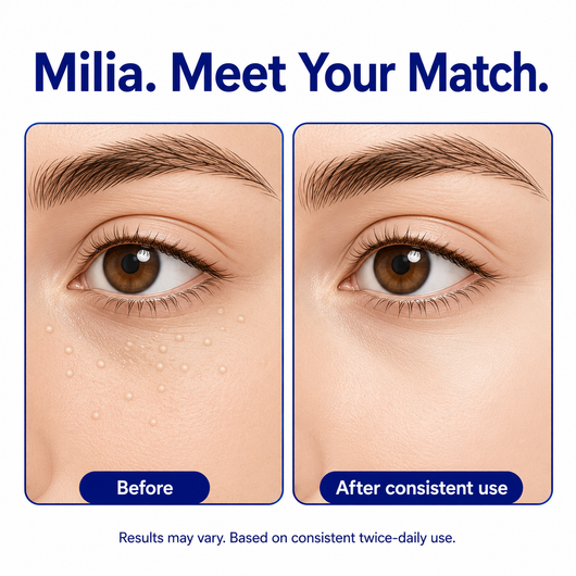 Dermfree Milia Remover