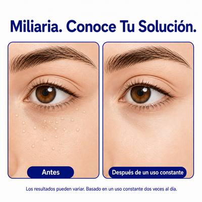DermFree Eliminador de milios
