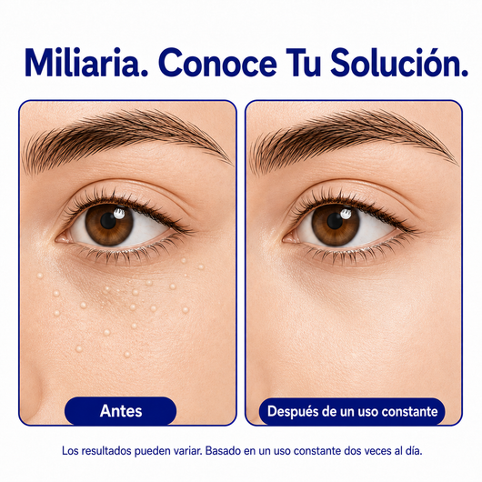 DermFree Eliminador de milios